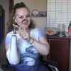 'Снаряды летали, как мячики': проходящая лечение в РФ после ранений в Сирии украинка два года не может увидеть семью (© Фото из личного архива) © Фото из личного архива