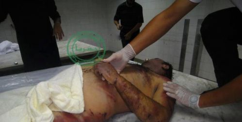 пытки ливийских патриотов