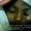 Ваша помощь пострадавшим в Джанзоуре! (На фото Hannin Saleh Aghielah, ей было 11 лет) На фото Hannin Saleh…