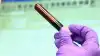 WADA готовит новые 'разоблачения' российских спортсменов (допинговый скандал 2016) допинговый скандал 2016