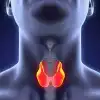 Диагностика и лечение гипотиреоза: как распознать заболевание щитовидной железы и вернуться к полноценной жизни (Гипотиреоз может маскироваться под другие заболевания) Гипотиреоз может мас…